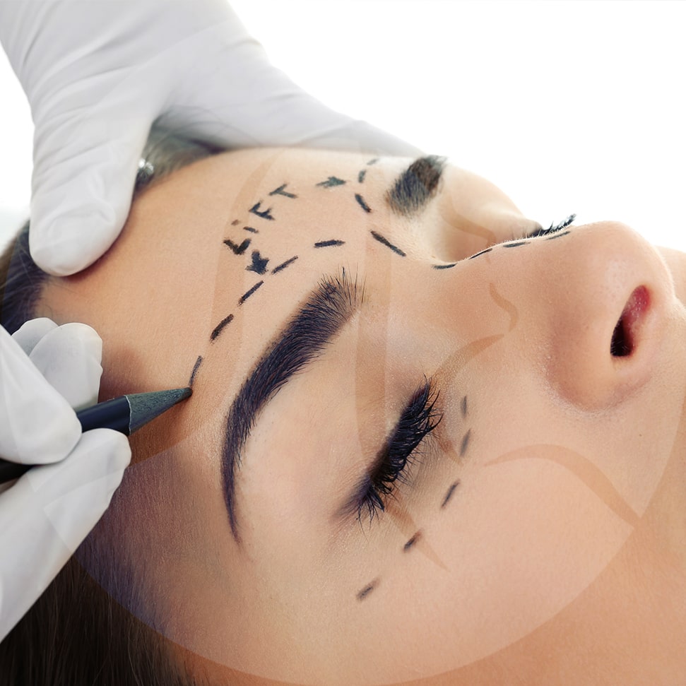 brow lift in cleveland