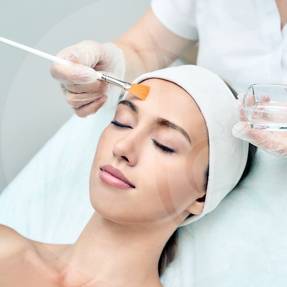 chemical peels in cleveland