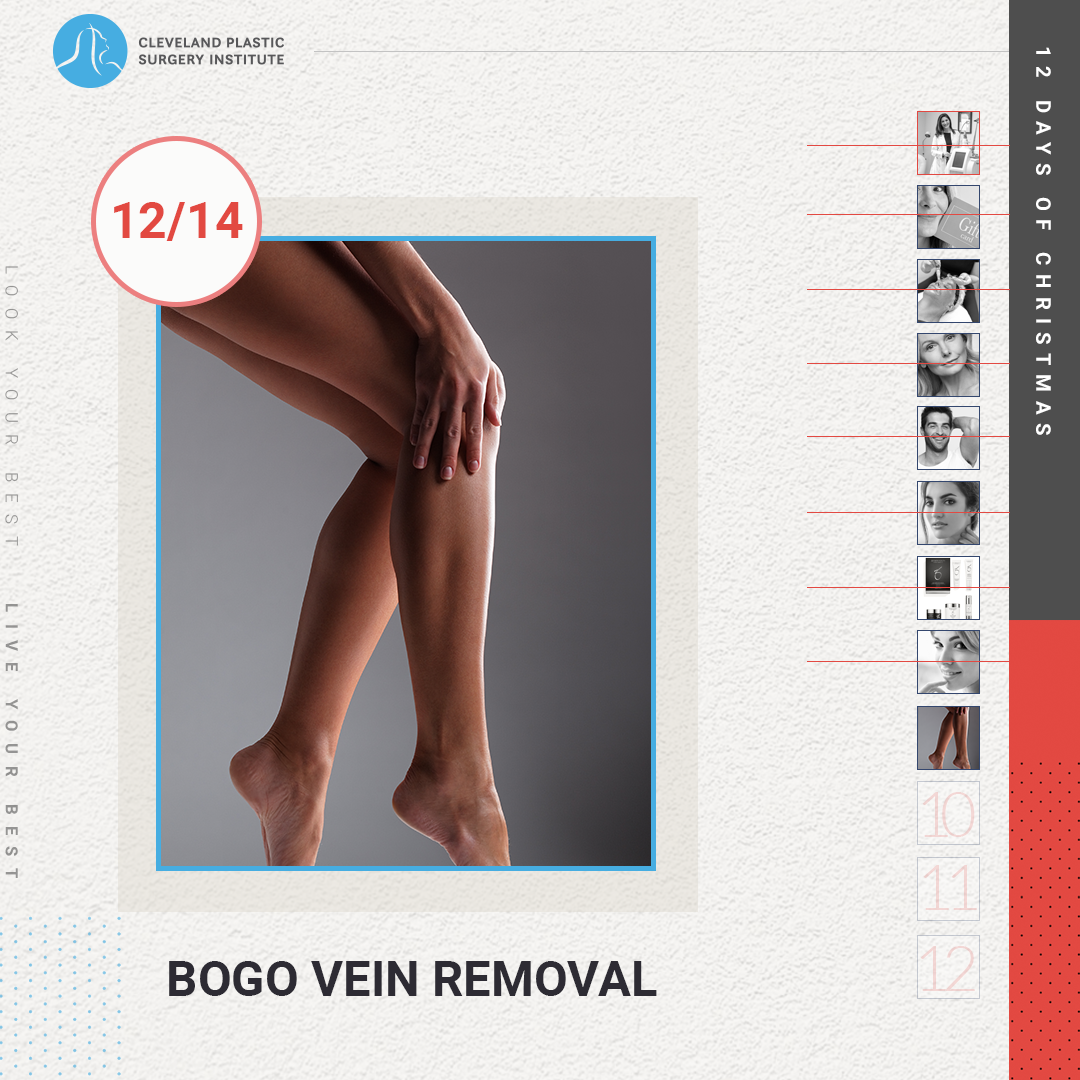 12 Days of Christmas Deals - Day 9 - BOGO Vein Removal